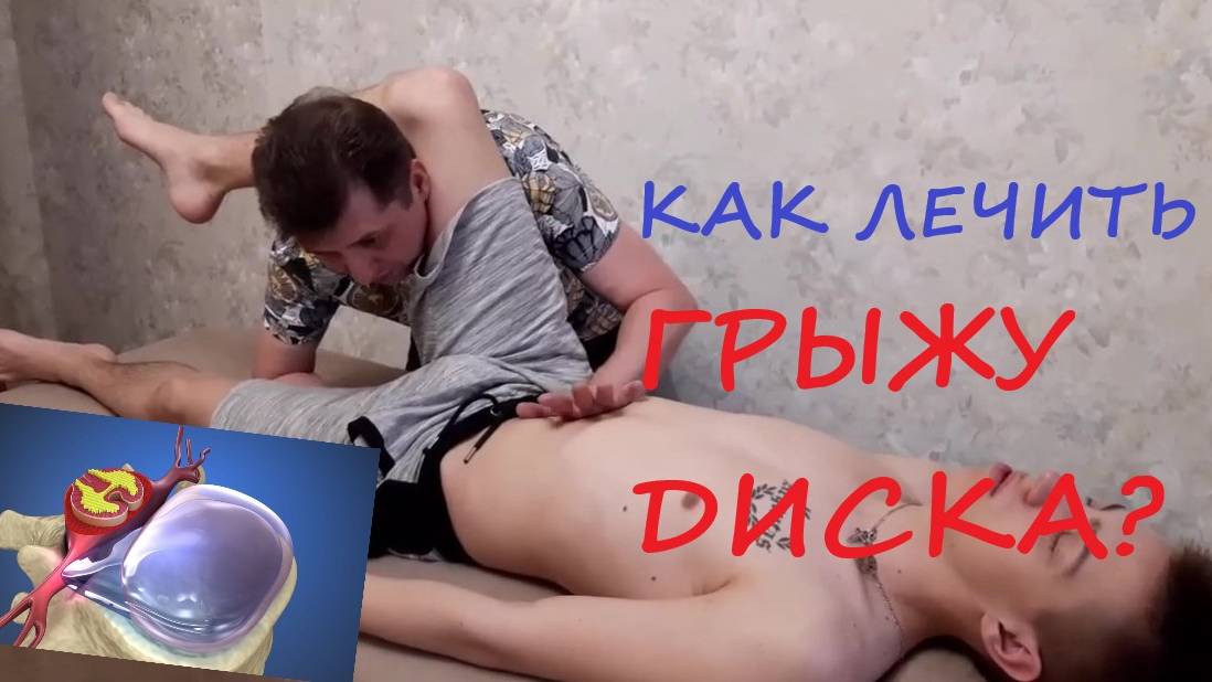 Как лечить грыжу в позвоночнике?