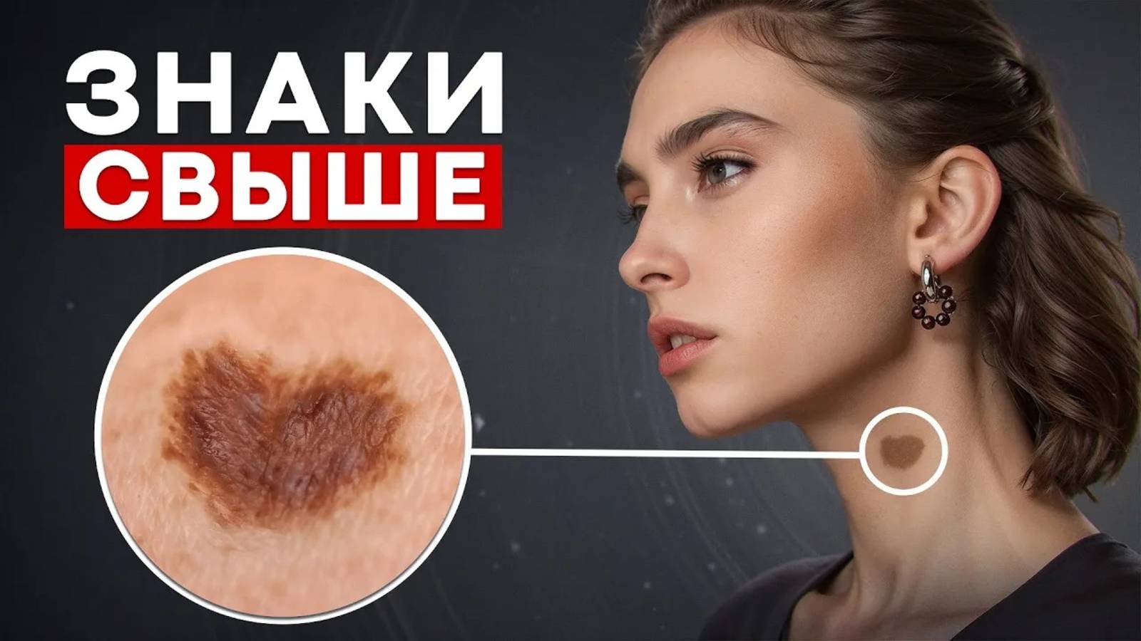 Эти УГРОЖАЮЩИЕ метки на теле! / Что означают родимые пятна?