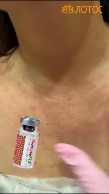 Полимолочная кислота