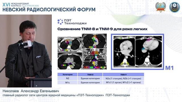 Рак легкого: TNM в 9 издании. Новые вызовы перед ПЭТ/КТ. При поддержке ООО"ПЭТ Технолоджи Балашиха
