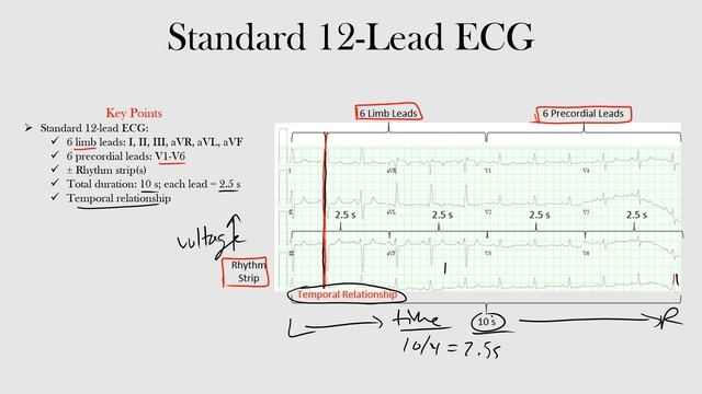 10.Standard 12-Lead ECG