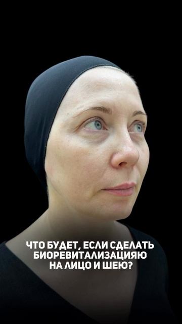 К нам обратилась пациентка, возраст 47 лет