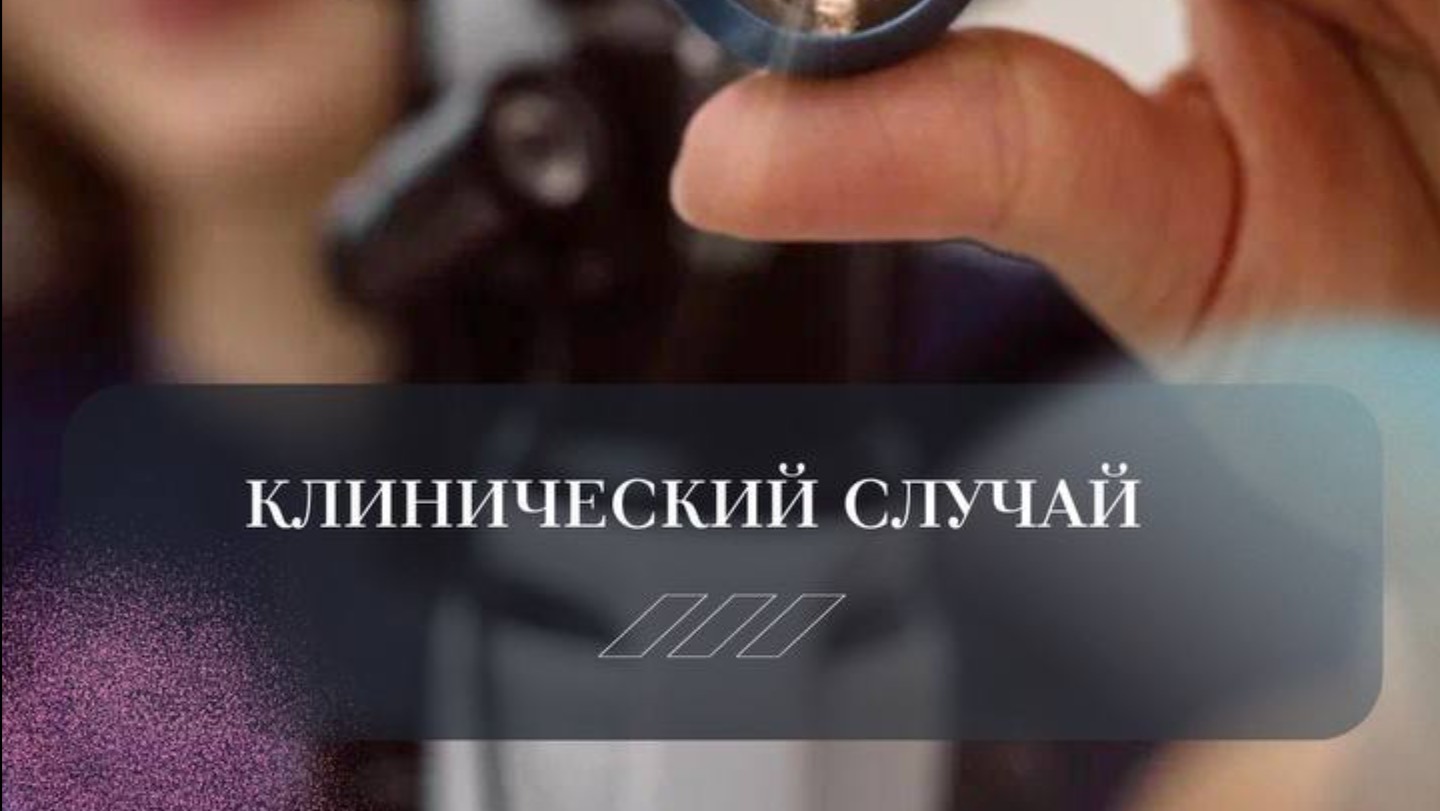 Клинический случай