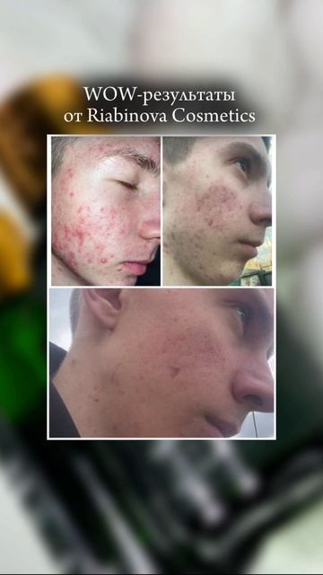 Когда результат клиента — это твоя лучшая визитка ✨