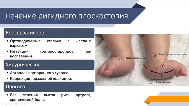 Травмы стопы и голеностопа, ч1