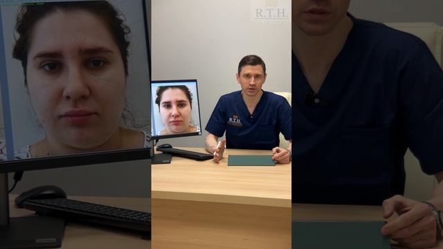 Коррекция малярных мешков с помощью липофилинга☀️
