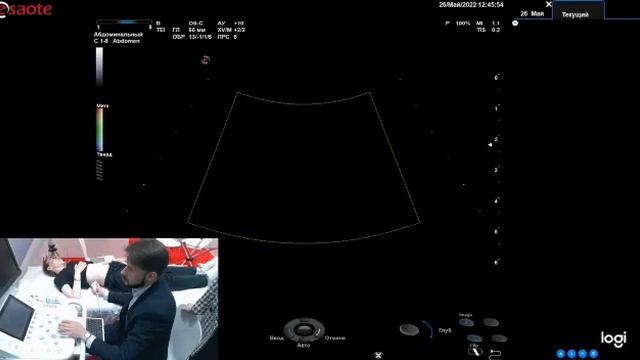 Процесс работы Esaote MyLab X8
