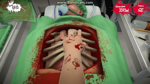 Surgeon Simulator:Неудачная попытка поиграть в неё!