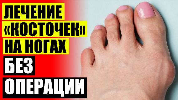 ПОЧЕМУ БОЛЯТ КОСТОЧКИ НА ПАЛЬЦАХ НОГ