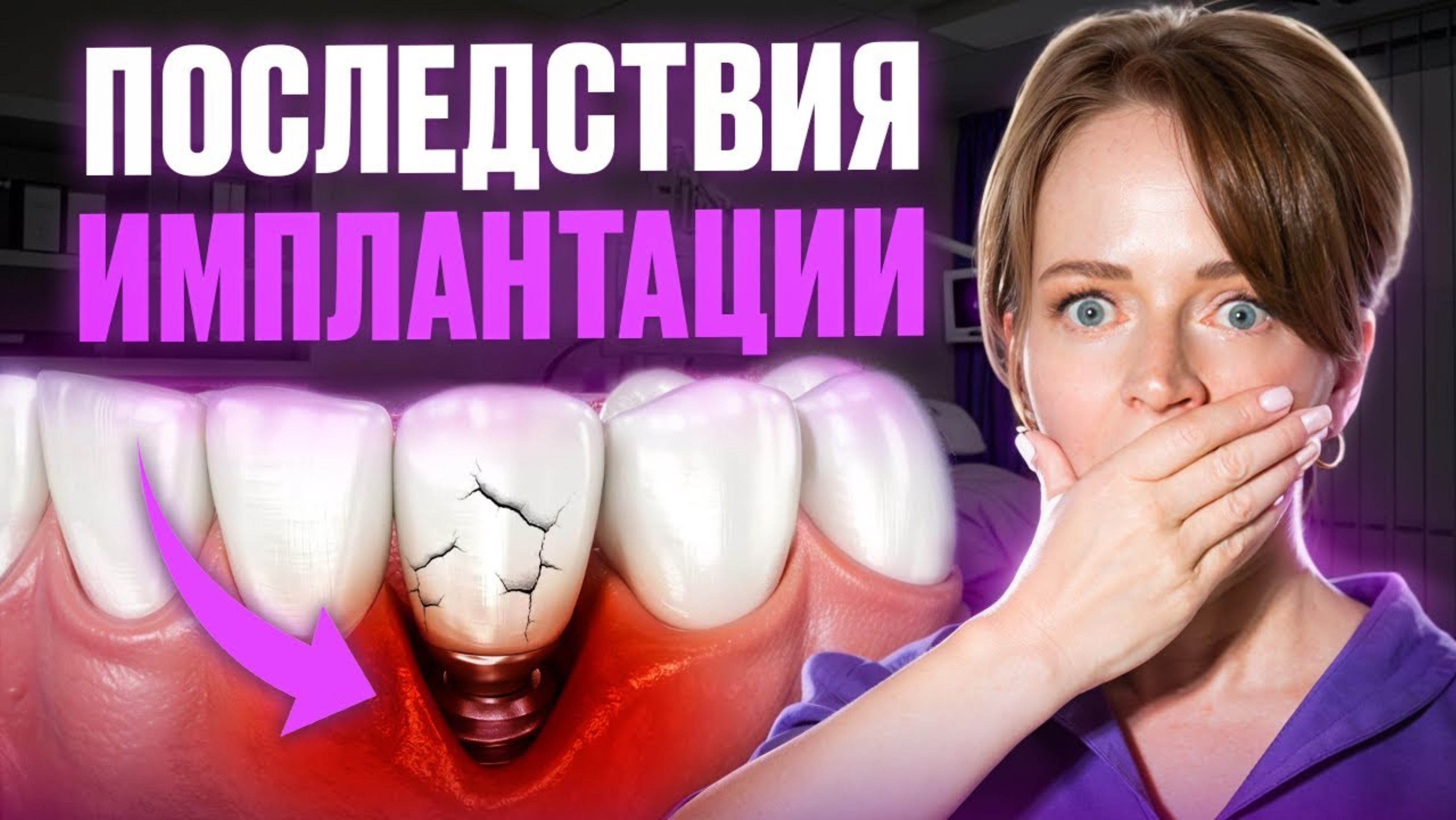 О ЧЕМ МОЛЧАТ ВРАЧИ? ЧТО МОЖЕТ ПОЙТИ НЕ ТАК ПОСЛЕ ИМПЛАНТАЦИИ ЗУБОВ?