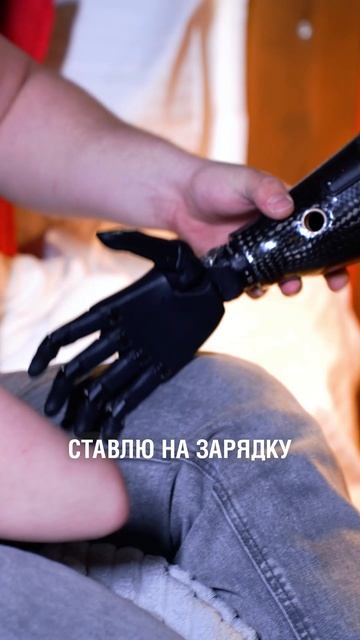 Зарядка бионического протеза