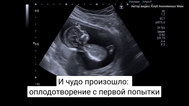 «Часики-то тикают». 31-летняя женщина, не найдя идеального мужа, стала мамой искусственным путем