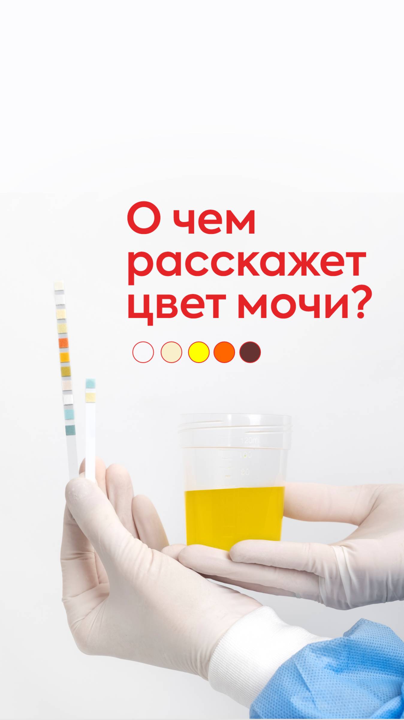 Моча — один из важных индикаторов состояния здоровья.Ее цвет может многое рассказать о работе почек