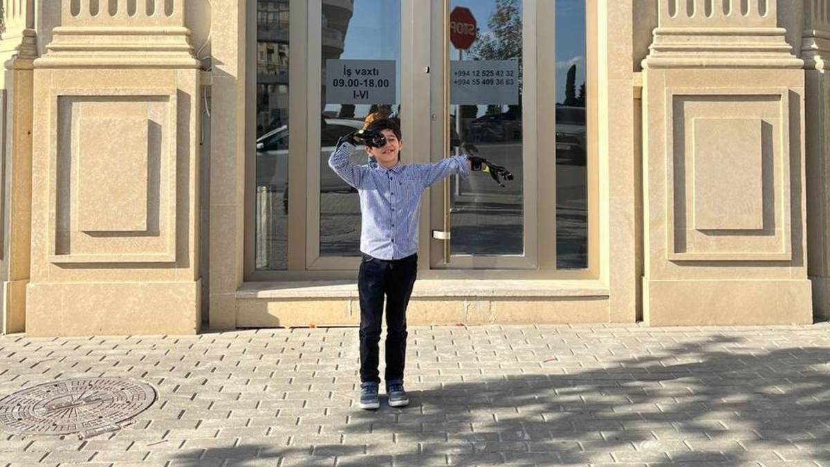 Подопечный Мамедли Юсиф получил 2 активных протеза рук.