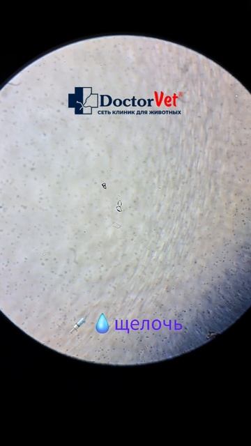Струвиты