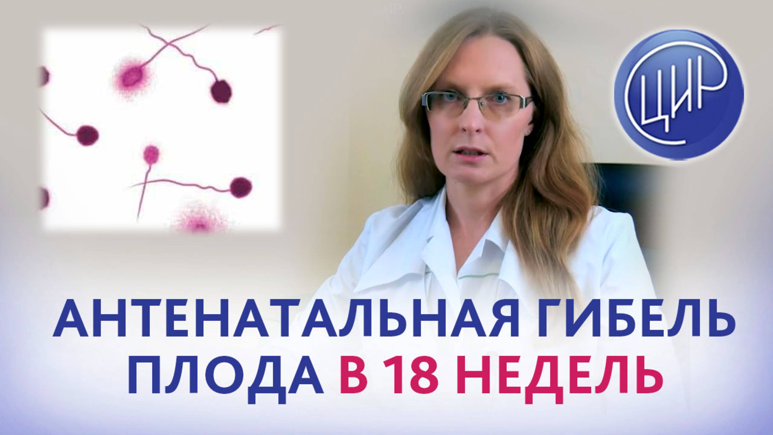 Имеет ли смысл проверять фрагментацию ДНК сперматозоидов, после остановки беременности на 18 неделе?