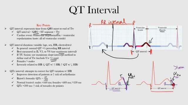 23.QT Interval
