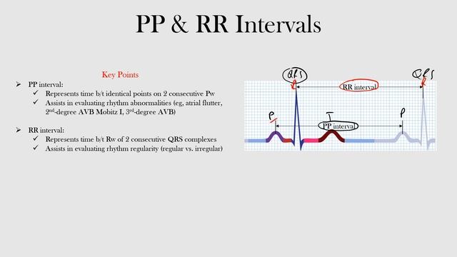 26.PP & RR Intervals