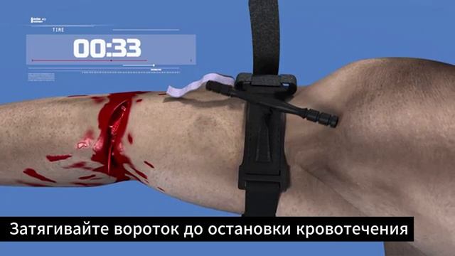 18.Проверка навыка наложения турникета за 1 минуту