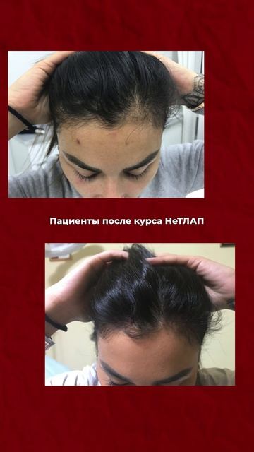 Еще больше до/после в наших соцсетях