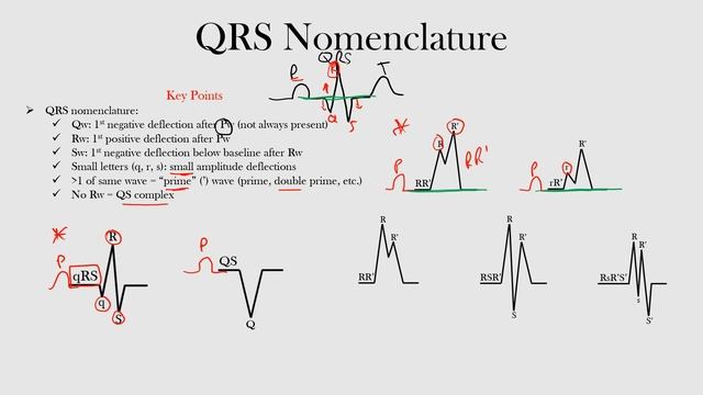 19.QRS Nomenclature