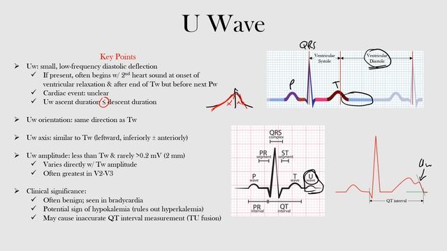 24.U Wave