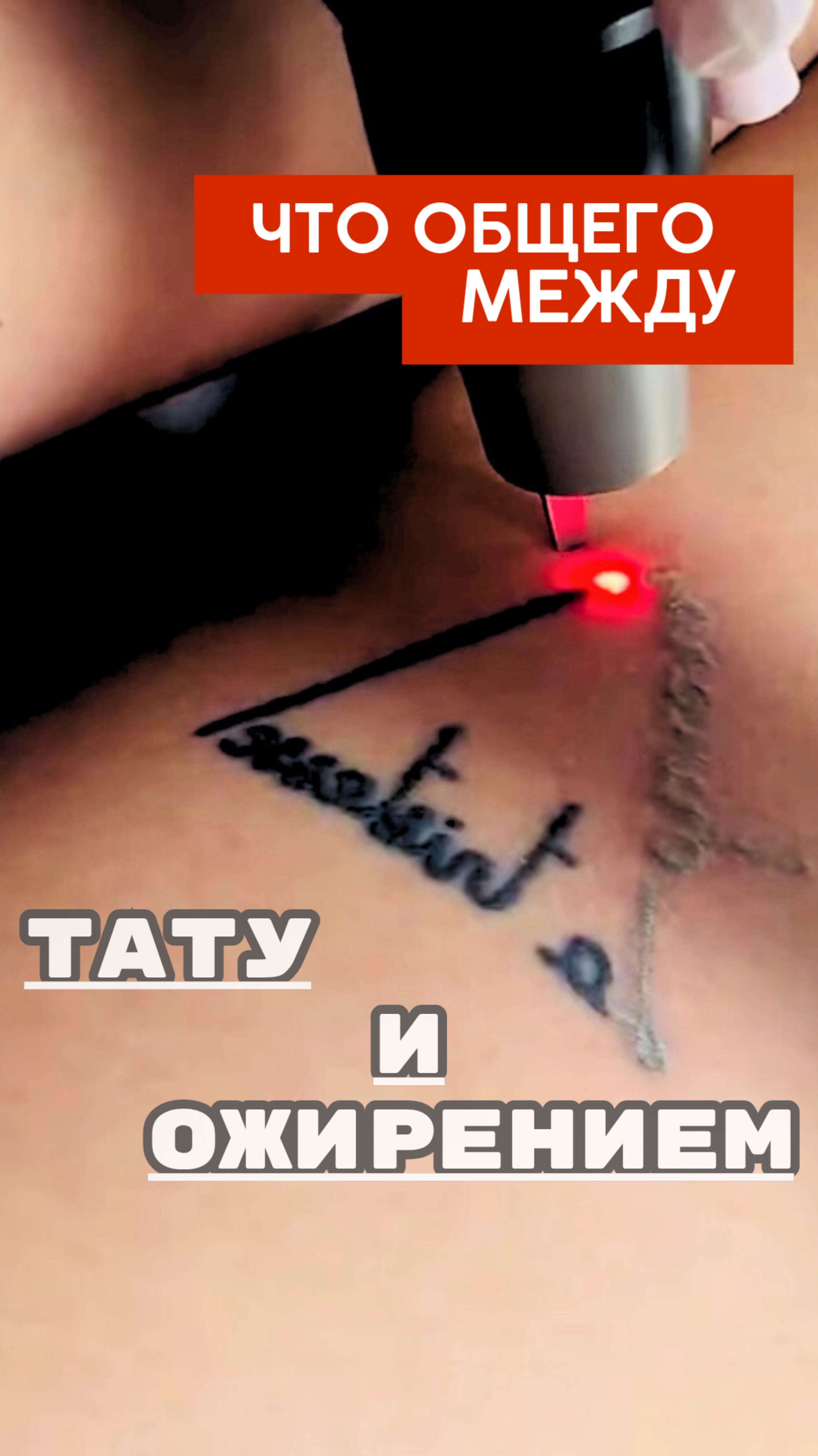 Что общего между татуировками и ожирением?