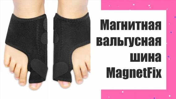 🤥 КОСТОЧКА НА БОЛЬШОМ ПАЛЬЦЕ ЛЕЧЕНИЕ