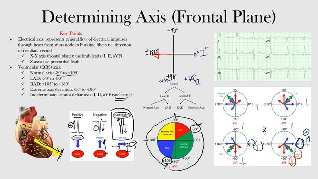 29.Determining Axis (Frontal Plane)