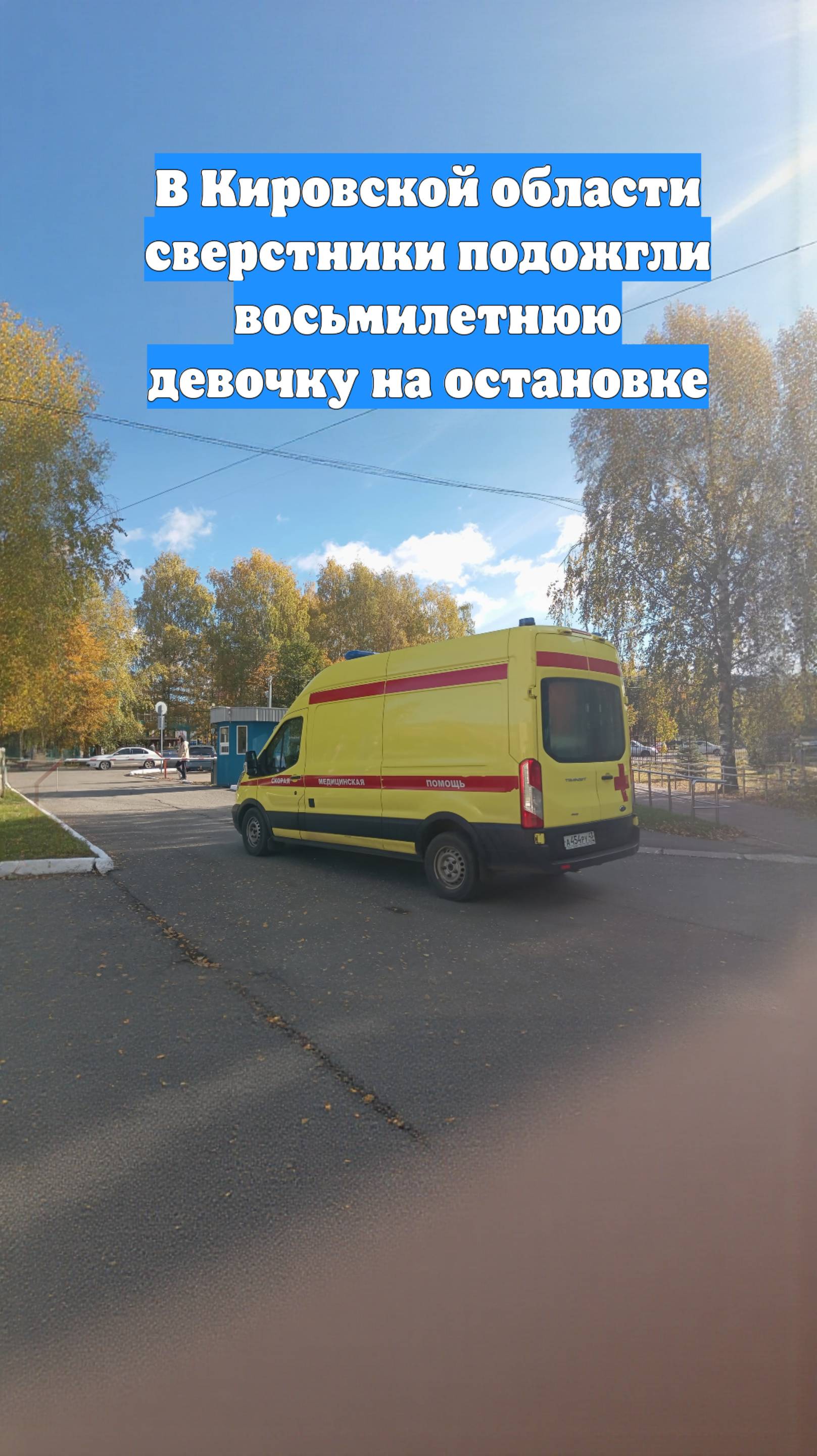 В Кировской области сверстники подожгли восьмилетнюю девочку на остановке