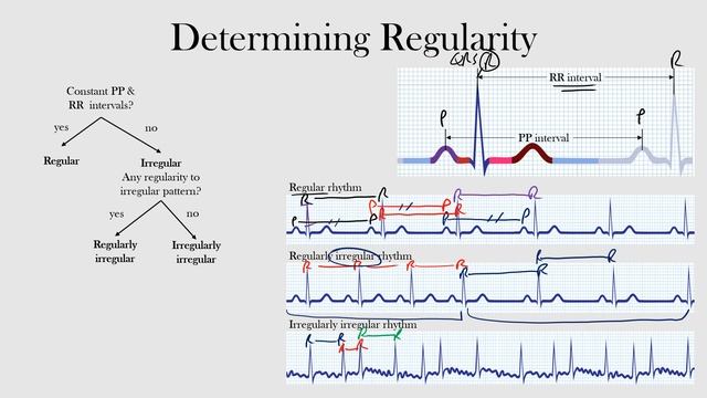 27.Determining Regularity
