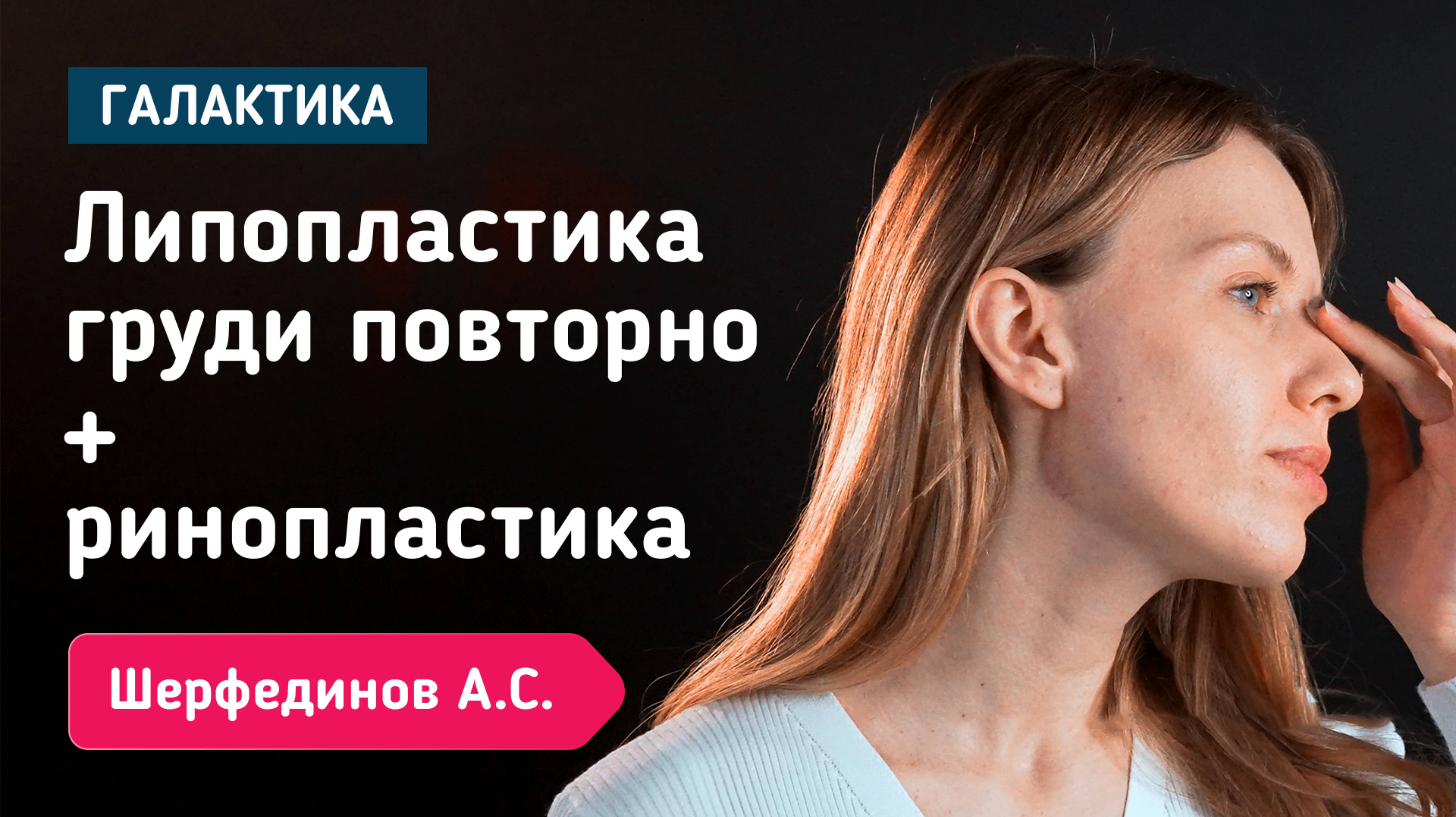 Повторная липопластика груди с ринопластикой | Шерфединов Арсений Сергеевич