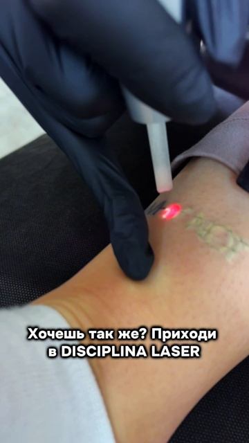 Хочешь так же?🤭 Ждём тебя на удаление❤️