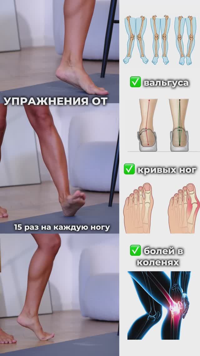Упражнения от вальгуса. Подпишись и читай описание ✅