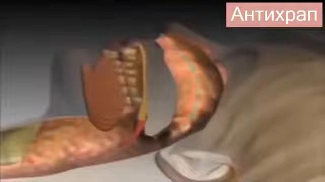 Силиконовая Клипса Антихрап 10173