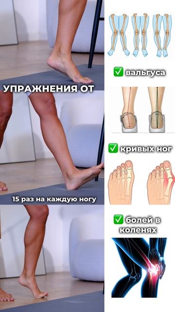 Упражнения от вальгуса. Подпишись и читай описание ✅