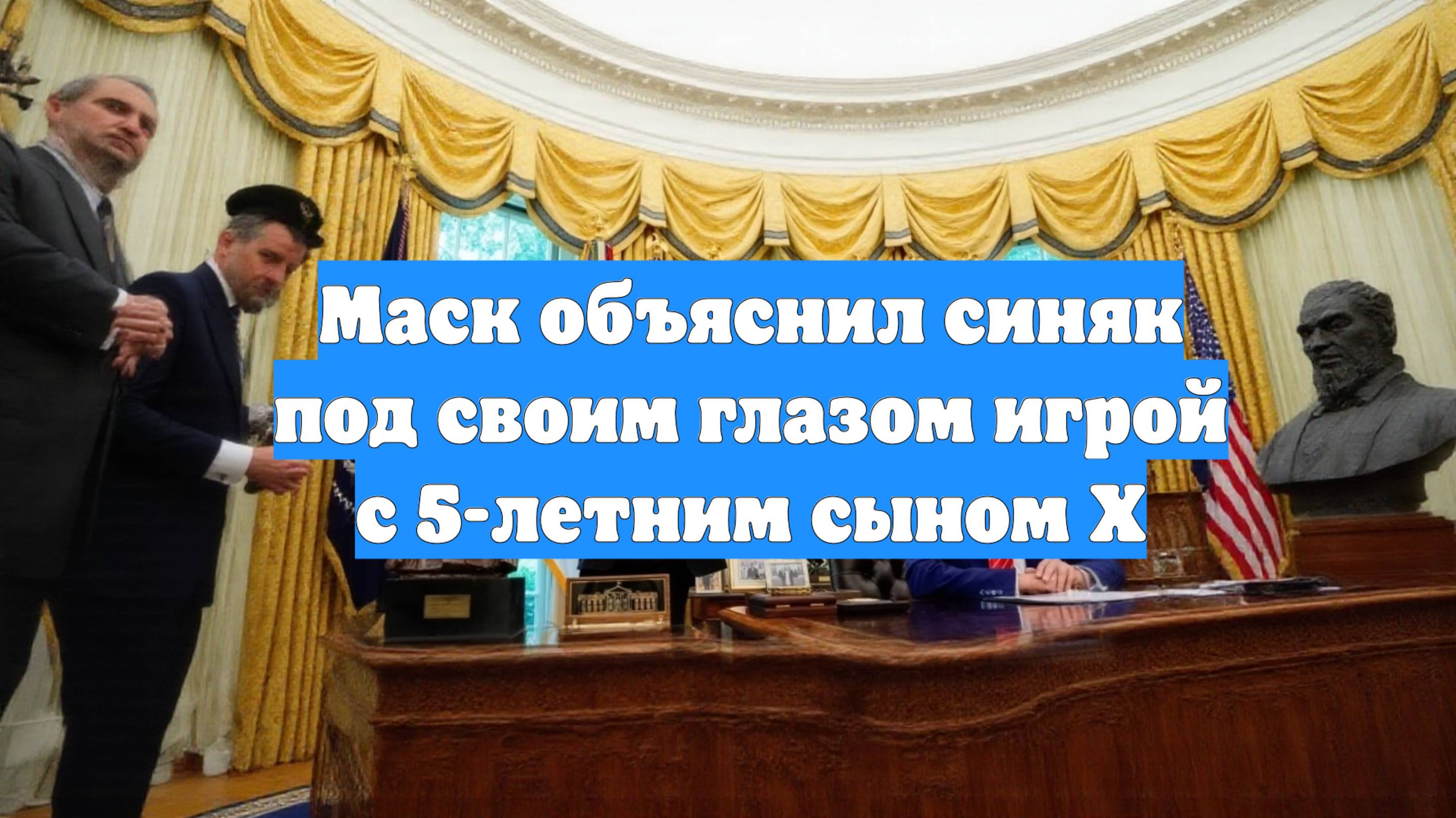 Маск объяснил синяк под своим глазом игрой с 5-летним сыном X