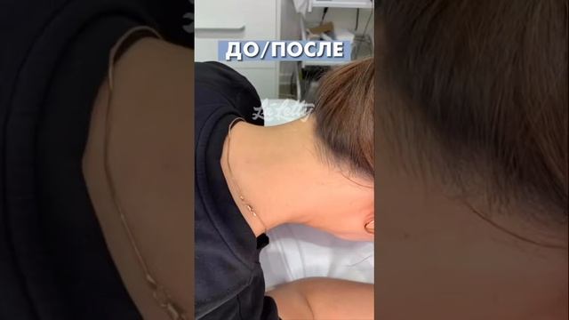 Кому подойдет лазерная эпиляция?