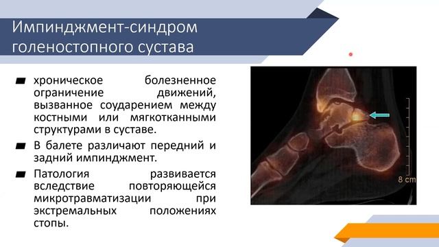 Стопа, часть 2