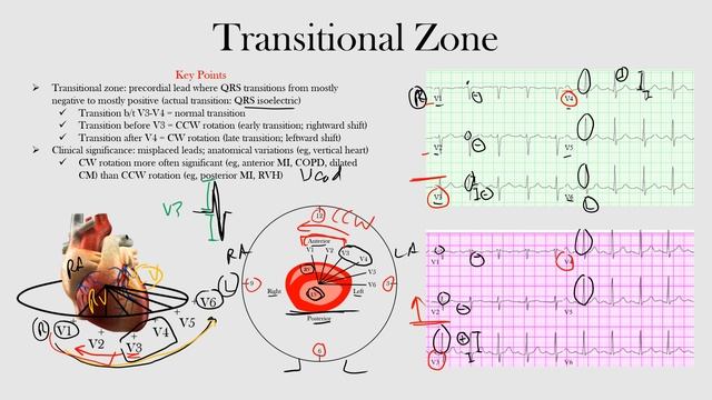 30.Transitional Zone
