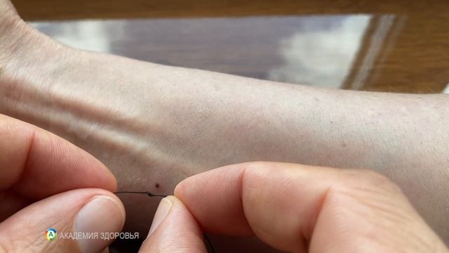Как правильно вытащить клеща ️ Безопасно и без последствий!