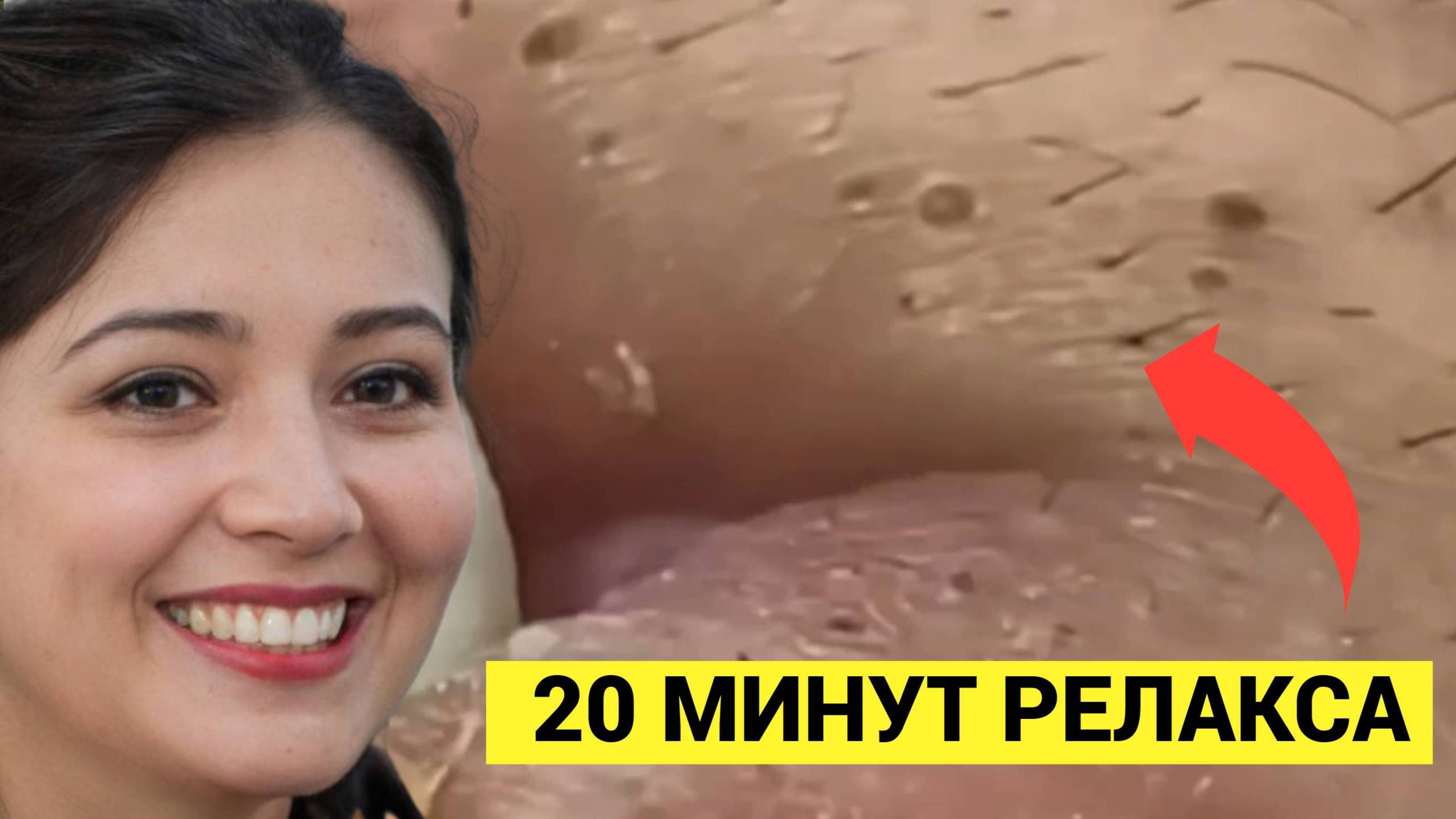 20 минут РЕЛАКС-ОБЗОР Выдавливания Желтых Комедонов и Жировиков. Расслабимся