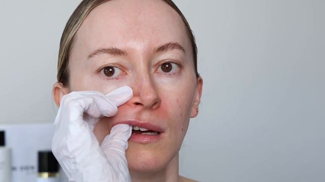 Как убрать носогубные морщины? Эффективный массаж дом