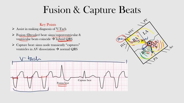 57.Fusion & Capture Beats