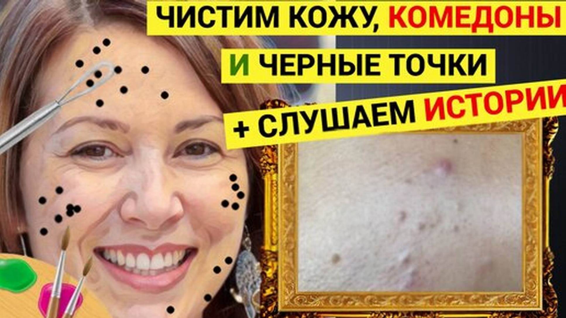 Прыщи 004 Высокомерная Девочка и её Расплата за Гордость надо было ей раньше думать