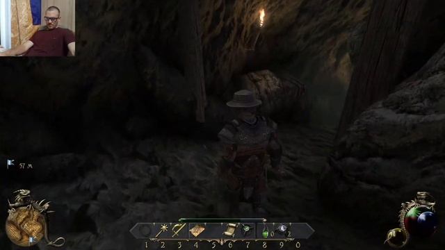 Two Worlds 2 КОПЛЮ НА ПЕРАЦИЮ НА ГЛАЗ