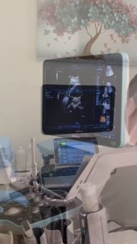 УЗИ в 4D – первая встреча с вашим малышом!