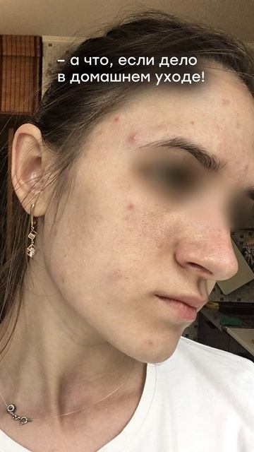 А что, если дело в домашнем уходе?