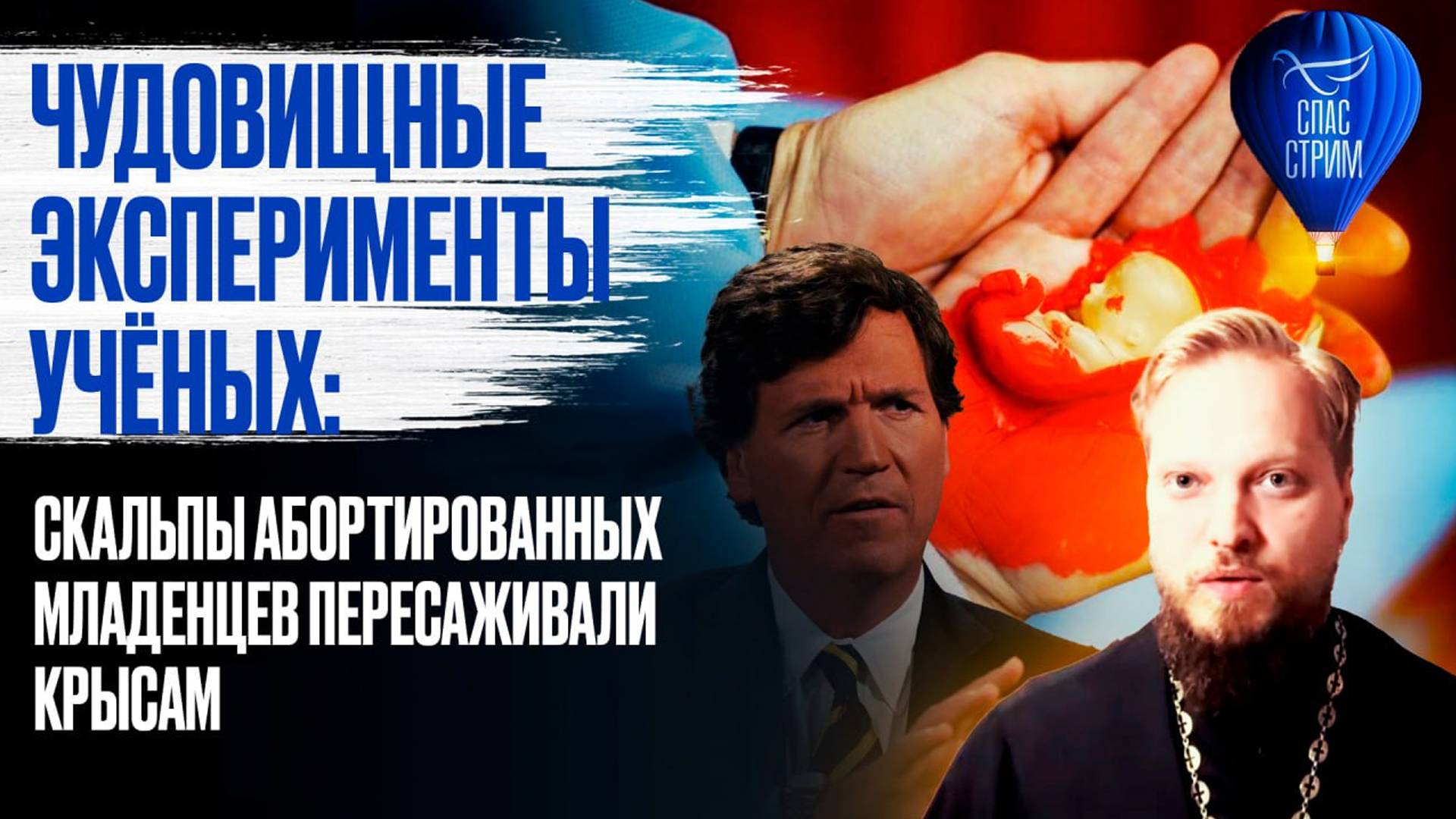 Чудовищные эксперименты учёных: скальпы абортированных младенцев пересаживали крысам