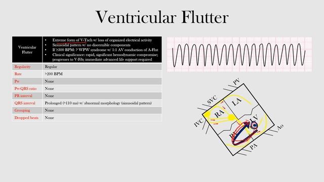62.Ventricular Flutter